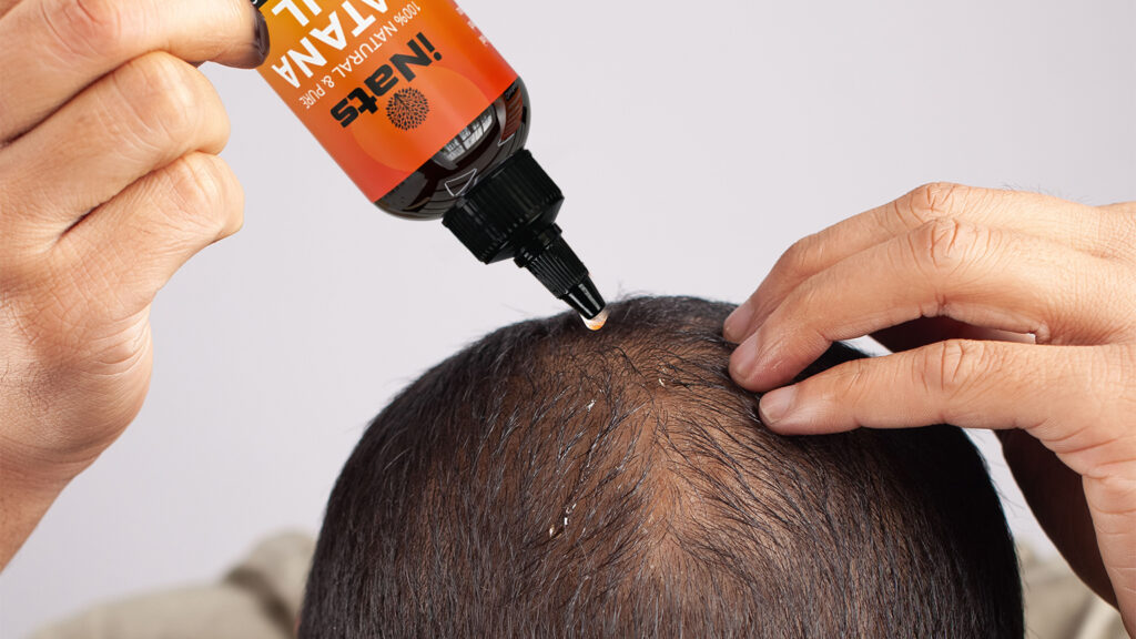Batana Oil for Specific Types of Alopecia- Custom Usage Tips